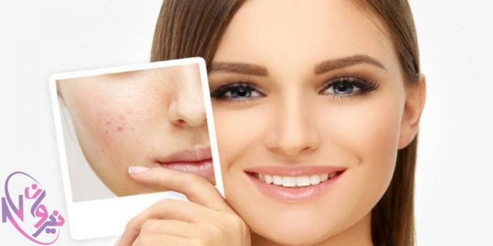 بهترین پرایمر پوست چرب